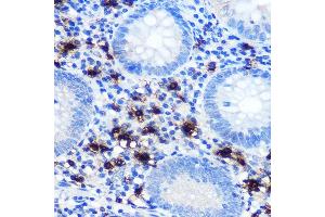 Immunohistochemistry of paraffin-embedded human appendix using Mast Cell Chymase (CM) (CM) Rabbit mAb (1480) at dilution of 1:100 (40x lens). (CMA1 antibody)