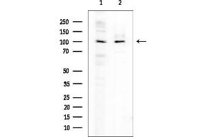 Western blot analysis of lysates from various samples, using BCL11A Mouse Monoclonal Antibody at 1/1000 dilution.