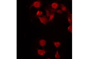 ABIN6272298 staining COLO205 by IF/ICC. (FUBP3 antibody  (Internal Region))
