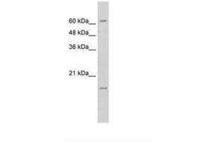 Image no. 1 for anti-Solute Carrier Family 13 Member 3 (SLC13A3) (AA 48-97) antibody (ABIN203480) (SLC13A3 antibody  (AA 48-97))