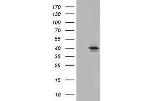HEK293T cells were transfected with the pCMV6-ENTRY control (Left lane) or pCMV6-ENTRY SLC30A3 (Right lane) cDNA for 48 hrs and lysed. (Slc30a3 antibody)