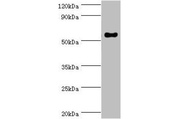 IFNGR1 anticorps  (AA 270-489)