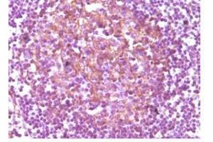 Immunohistochemical analysis of paraffin-embedded human lymphnode, showing membrane localization using CD14 antibody with DAB staining. (CD14 antibody)
