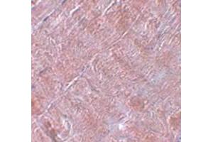 Immunohistochemical staining of human skeletal muscle tissue with RANBP10 polyclonal antibody  at 5 ug/mL dilution.