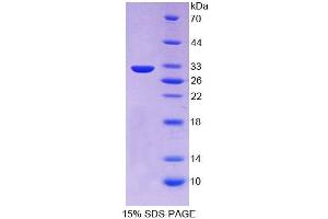 SDS-PAGE (SDS) image for Proprotein Convertase Subtilisin/kexin Type 1 (PCSK1) (AA 500-738) protein (His tag) (ABIN6237036) (PCSK1 Protein (AA 500-738) (His tag))