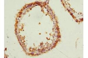 Immunohistochemistry of paraffin-embedded human testis tissue using ABIN7162885 at dilution of 1:100 (PCM1 antibody  (AA 1-260))