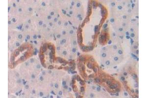Detection of CTSD in Rat Kidney Tissue using Polyclonal Antibody to Cathepsin D (CTSD) (Cathepsin D antibody  (AA 120-407))