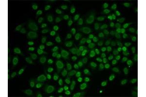 Immunofluorescence (IF) image for anti-RAD54-Like 2 (RAD54L2) antibody (ABIN1877130) (ARIP4 antibody)