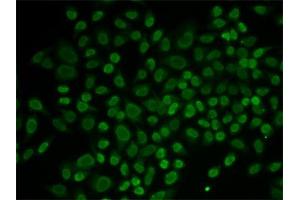 Immunofluorescence (IF) image for anti-RAD54-Like 2 (RAD54L2) antibody (ABIN1877130) (ARIP4 antibody)
