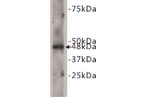 Western Blotting (WB) image for anti-Cadherin EGF LAG Seven Pass G-Type Receptor 2 (CELSR2) antibody (ABIN1854843)