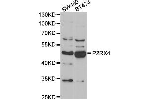 Western blot analysis of extracts of various cell lines, using P2RX4 antibody (ABIN5974027) at 1/1000 dilution.
