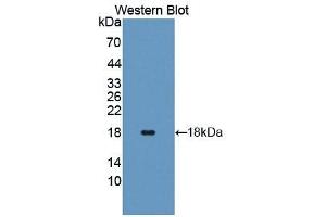 Detection of Recombinant ANG, Human using Polyclonal Antibody to Angiogenin (ANG) (ANG antibody  (AA 25-147))