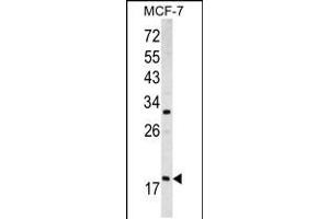 Western blot analysis of ARF3 antibody (Center D93) in MCF-7 cell line lysates (35ug/lane)