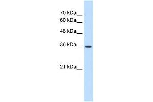 MAS1 antibody used at 1. (MAS1 antibody  (Middle Region))