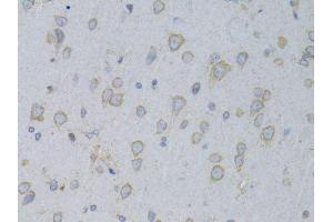 Immunohistochemistry of paraffin-embedded rat brain using GARS antibody. (GARS antibody  (AA 60-370))