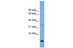 WB Suggested Anti-SLC25A44 Antibody Titration:  0. (SLC25A44 antibody  (Middle Region))