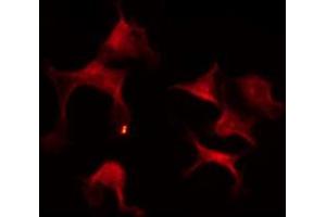 ABIN6272435 staining NIH-3T3 by IF/ICC. (STAM2 antibody)