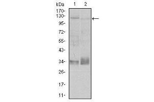 Image no. 2 for anti-Integrin beta 1 (ITGB1) antibody (ABIN1498893) (ITGB1 antibody)