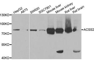 Western blot analysis of extracts of various cell lines, using ACSS2 antibody (ABIN5973869) at 1/1000 dilution. (ACSS2 antibody)