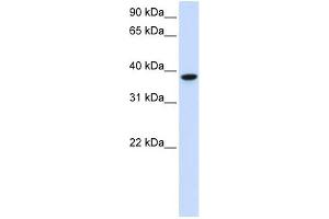 GLT8D2 antibody used at 1 ug/ml to detect target protein. (GLT8D2 antibody  (C-Term))