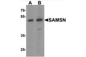 Western blot analysis of SAMSN in Hela cell lysate with SAMSN Antibody  at (A) 0.