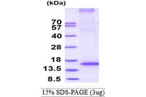 SDS-PAGE (SDS) image for Ring Finger Protein 7 (RNF7) (AA 1-113) protein (His tag) (ABIN5853188) (RNF7 Protein (AA 1-113) (His tag))