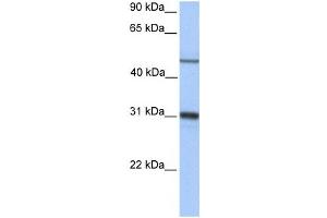 Western Blotting (WB) image for anti-Epoxide Hydrolase 1, Microsomal (Xenobiotic) (EPHX1) antibody (ABIN2459723) (EPHX1 antibody)