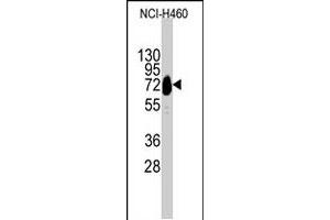 Western blot analysis of CDH10 polyclonal antibody  in NCI-H460 cell line lysates (35 ug/lane). (CDH10 antibody  (C-Term))