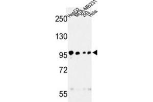 Western Blotting (WB) image for anti-Microtubule Associated serine/threonine Kinase-Like (MASTL) antibody (ABIN3003015) (MASTL antibody)