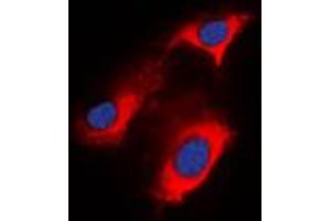 Immunofluorescent analysis of APC staining in HeLa cells. (APC antibody  (C-Term))