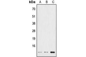 Western blot analysis of HSPE1 expression in HeLa (A), NIH3T3 (B), PC12 (C) whole cell lysates. (HSPE1 antibody  (Center))