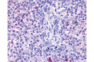 Anti-FPR3 / FPRH2 antibody IHC of human spleen. (FPR3 antibody  (Transmembrane Domain))