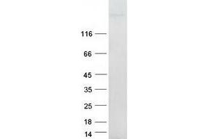 Validation with Western Blot (Integrin beta 4 Protein (ITGB4) (Transcript Variant 1) (Myc-DYKDDDDK Tag))