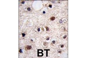 Formalin-fixed and paraffin-embedded human brain tissue reacted with JMJD3 (N-term) (ABIN387862 and ABIN2844039) , which was peroxidase-conjugated to the secondary antibody, followed by DAB staining.