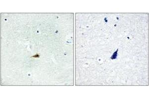 Immunohistochemistry analysis of paraffin-embedded human brain tissue, using NCOR2 Antibody. (NCOR2 antibody  (AA 511-560))