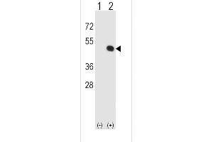 Western blot analysis of HLA-E using rabbit polyclonal HLA-E Antibody using 293 cell lysates (2 ug/lane) either nontransfected (Lane 1) or transiently transfected (Lane 2) with the HLA-E gene. (HLA-E antibody  (AA 108-135))