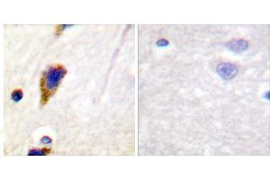 Peptide - +Immunohistochemical analysis of paraffin-embedded human brain tissue using Dynamin-1 (Ab-774) Antibody (#B0422). (Dynamin 1 antibody  (Ser774))