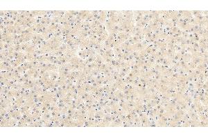 Detection of VEGF165 in Porcine Liver Tissue using Monoclonal Antibody to Vascular Endothelial Growth Factor 165 (VEGF165) (VEGF 165 (AA 28-191) antibody)