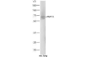 Mouse lung lysates probed with Rabbit Anti-PEPT1 Polyclonal Antibody, Unconjugated (ABIN2559661) at 1:300 in 4˚C. (SLC15A1 antibody  (AA 421-520))