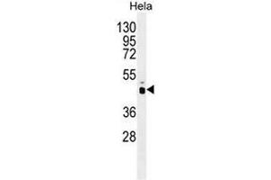 PRKAG1 Antibody (N-term) western blot analysis in Hela cell line lysates (35µg/lane). (PRKAG1 antibody  (N-Term))