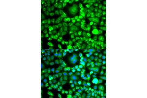 Immunofluorescence analysis of MCF-7 cells using BLID antibody (ABIN4903053). (BLID antibody)