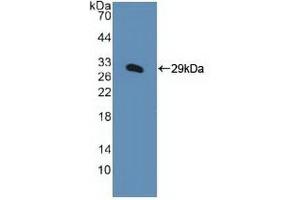 Detection of Recombinant KPNa1, Human using Polyclonal Antibody to Karyopherin Alpha 1 (KPNa1) (KPNA1 antibody  (AA 239-506))