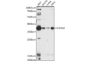 Western blot analysis of extracts of various cell lines, using CLNS1A antibody (ABIN6134287, ABIN6138737 and ABIN7101855) at 1:1000 dilution.