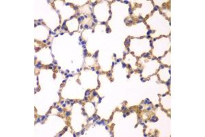 Immunohistochemistry of paraffin-embedded mouse lung using EPB41 antibody at dilution of 1:200 (400x lens).