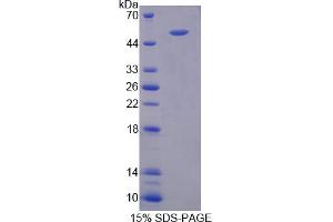 Image no. 1 for CD58 (CD58) (AA 1-214) protein (GST tag,His tag) (ABIN6236705) (CD58 Protein (CD58) (AA 1-214) (GST tag,His tag))