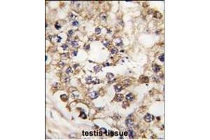 Formalin-fixed and paraffin-embedded human testis tissue reacted with PDX1 Antibody (N-term) (ABIN392140 and ABIN2841872) , which was peroxidase-conjugated to the secondary antibody, followed by DAB staining. (PDX1 antibody  (N-Term))