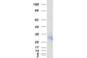 Validation with Western Blot