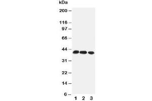 Western blot testing of CCR4 antibody and Lane 1:  mouse thymus;  2: mouse spleen;  3: (m) HEPA cell lysate (CCR4 antibody  (Middle Region))