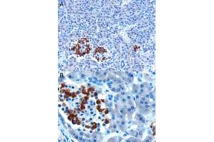 ABIN185408 (10µg/ml) staining of paraffin embedded Human Pancreas. (CCKAR antibody  (Internal Region))