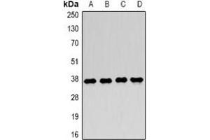 Western blot analysis of LDHA expression in MCF7 (A), Jurkat (B), NIH3T3 (C), mouse skeletal muscle (D) whole cell lysates. (Lactate Dehydrogenase A antibody)